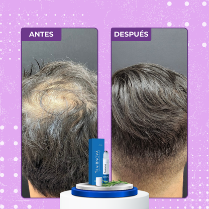 HAIRNOVA™ | Recupera Tu Cabello Perdido en solo una semana