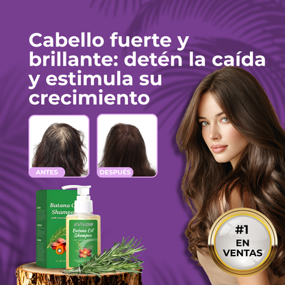 BATANA GOLD™ | DETÉN LA CAÍDA Y REVIVE TU CABELLO DESDE LA RAÍZ EN SOLO 1 SEMANA