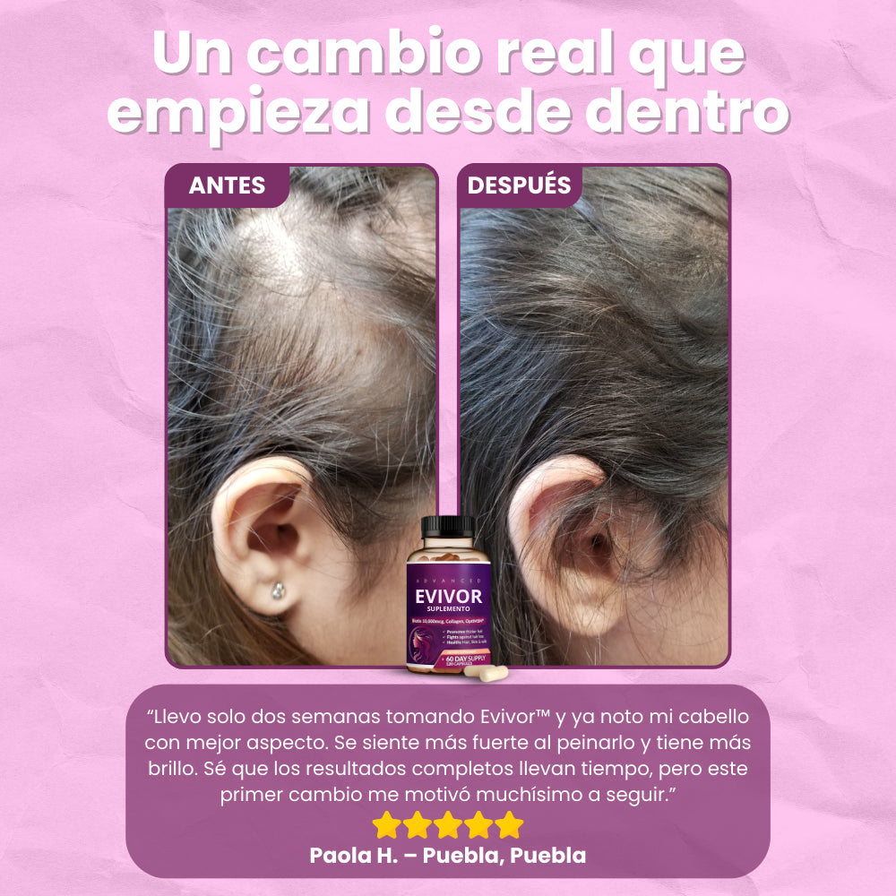 Evivor™ | Suplemento Capilar con Biotina 10,000 mcg y Colágeno – 120 Cápsulas