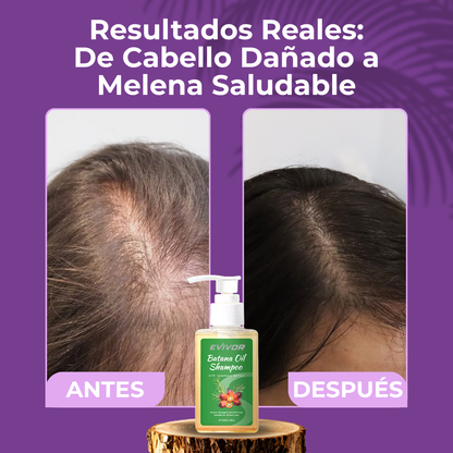 BATANA GOLD™ | DETÉN LA CAÍDA Y REVIVE TU CABELLO DESDE LA RAÍZ EN SOLO 1 SEMANA