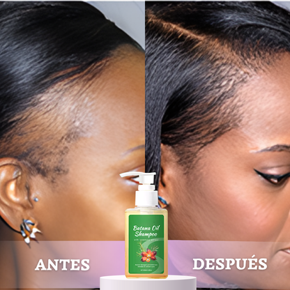 BATANA GOLD™ | DETÉN LA CAÍDA Y REVIVE TU CABELLO DESDE LA RAÍZ EN SOLO 1 SEMANA