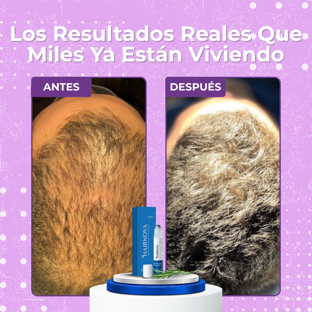 HAIRNOVA™ | Recupera Tu Cabello Perdido en solo una semana