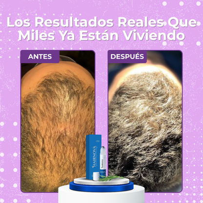 HAIRNOVA™ | Recupera Tu Cabello Perdido en solo una semana